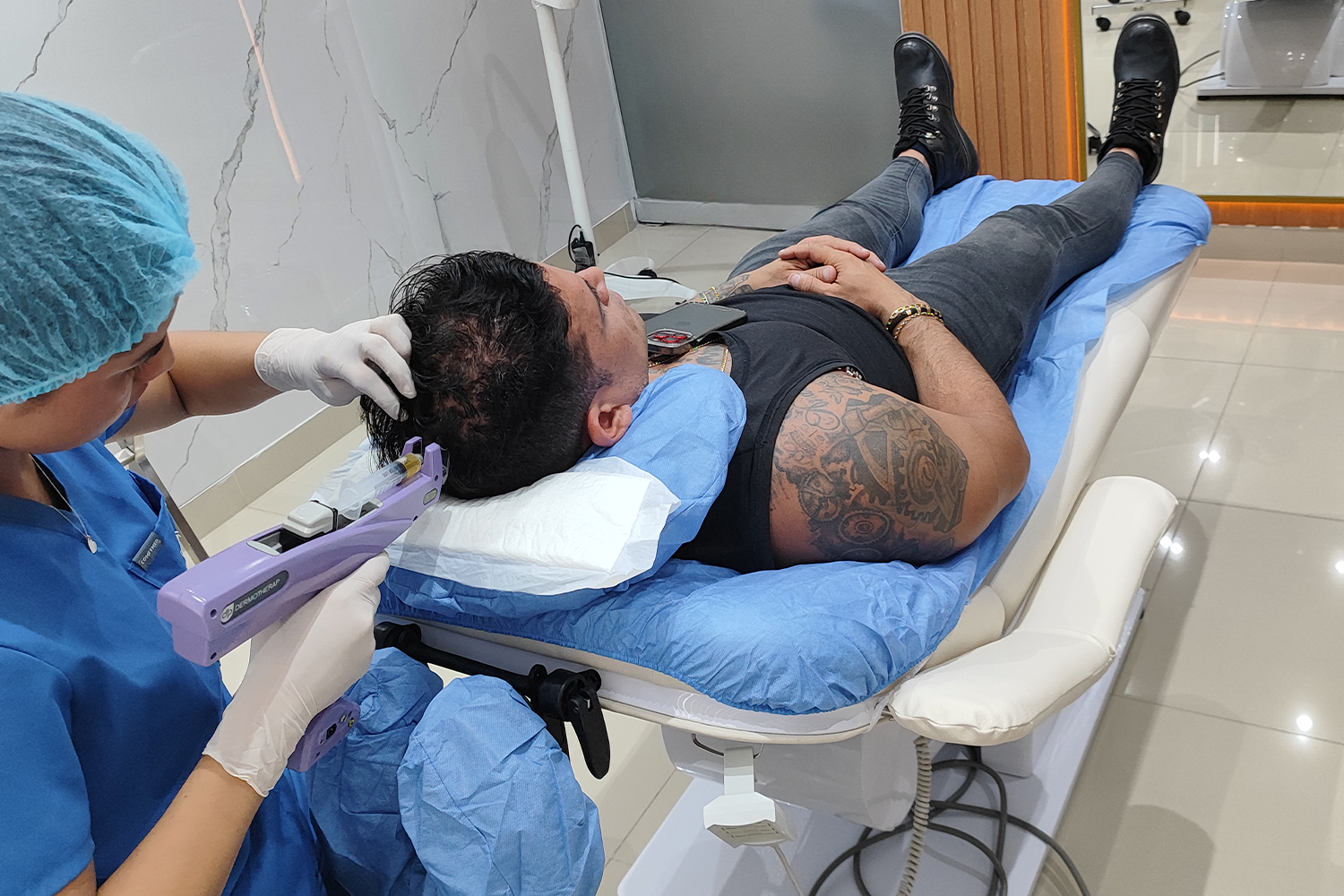 Mesoterapia Capilar: Un Tratamiento Efectivo para la Pérdida de Cabello