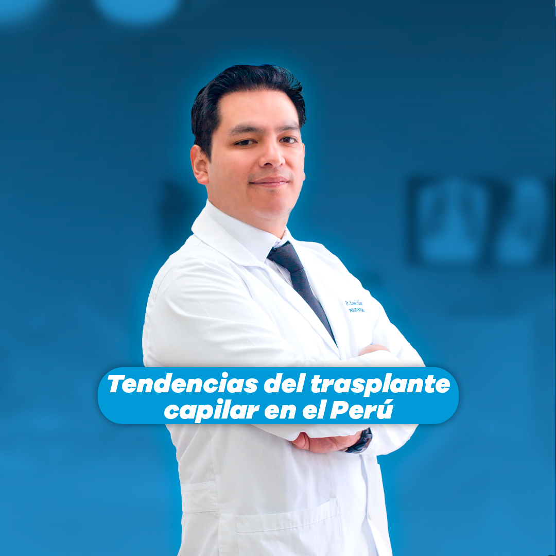 Tendencias del trasplante capilar en Perú