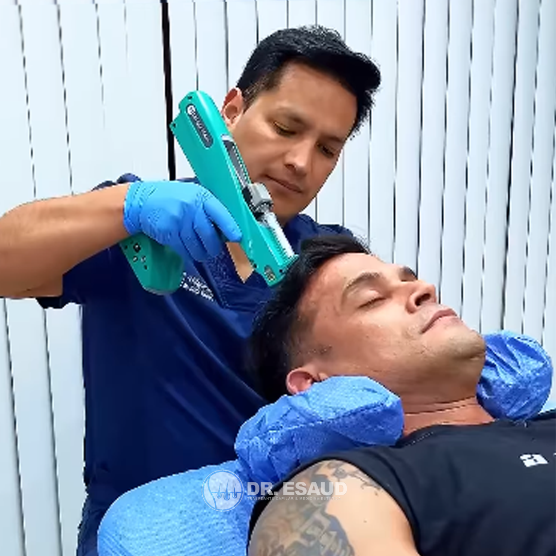 Christian Dominguez en una mesoterapia con el Dr. Esaud Trasplante Capilar