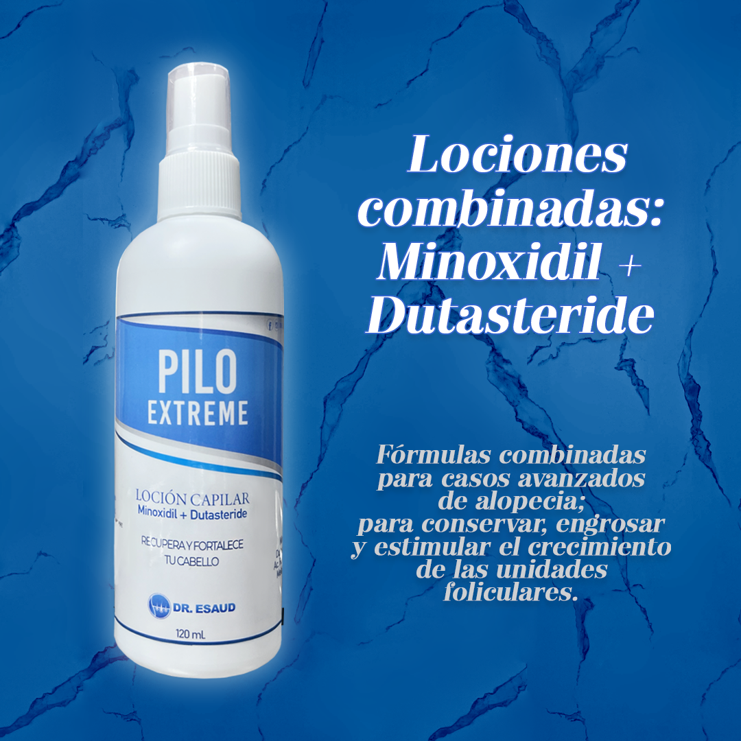locion minoxidil dutasteride dr esaud