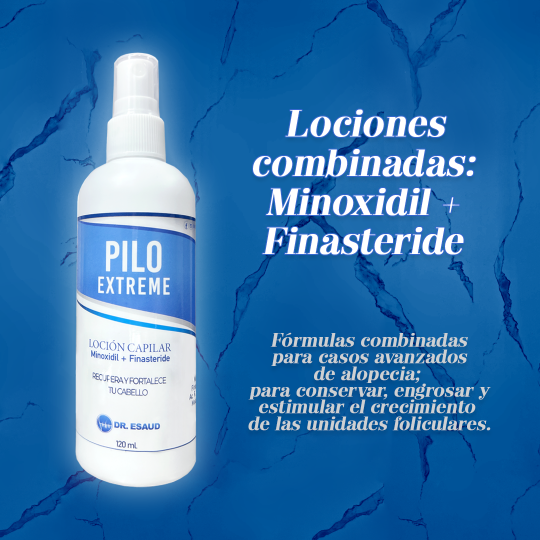locion minoxidil finasteride dr esaud