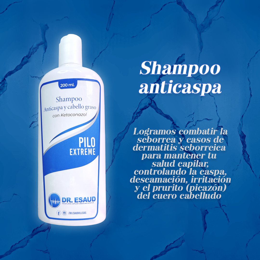 shampoo anticaspa dr esaud trasplante capilar